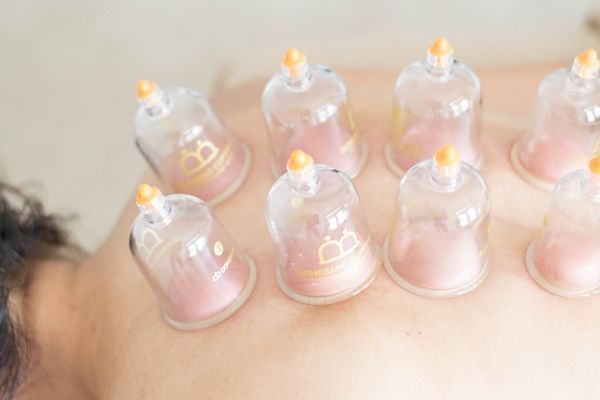 cupping-therapy-vienne-phytominero.com